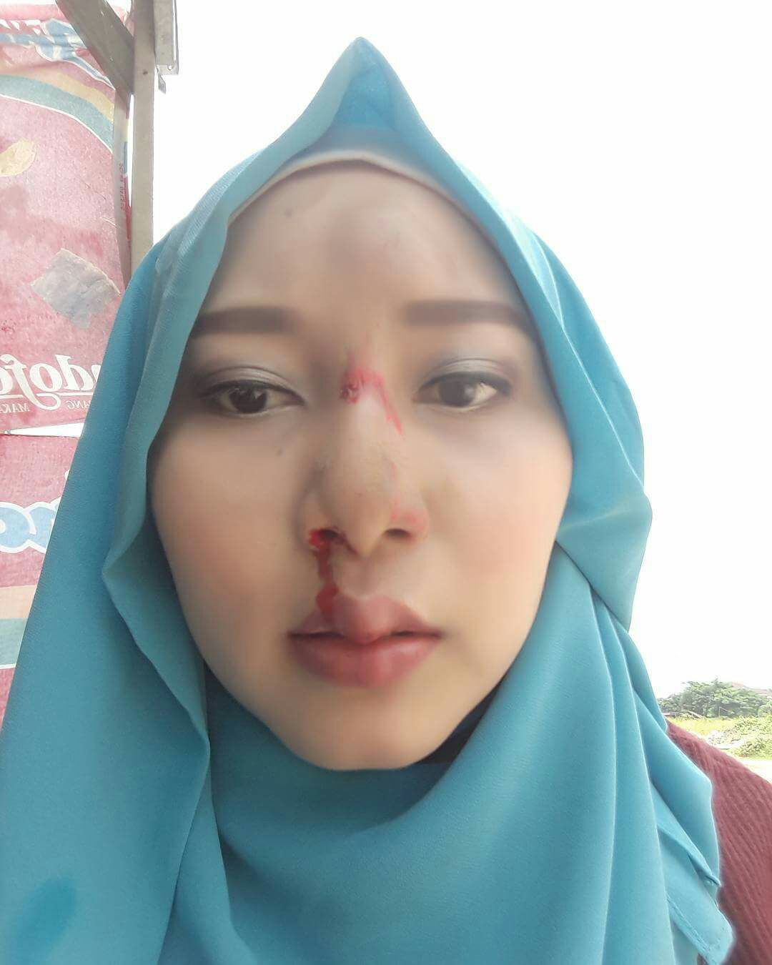 Luka membuat selfie ku lebih unik #CaptureTheRealYou