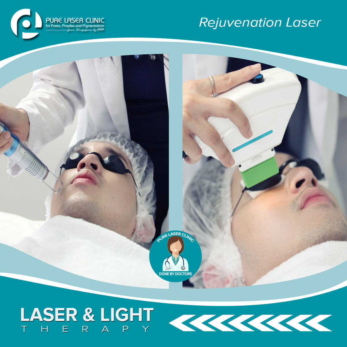 Treatment laser yang bener-bener ampuh untuk mengeatasi jerawat secara cepat